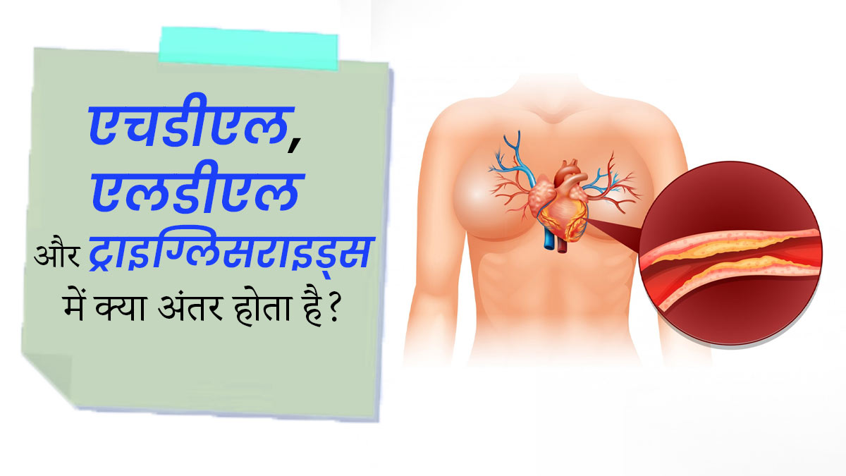 ट्राइग्लिसराइड्स, एचडीएल और एलडीएल कोलेस्ट्रॉल में क्या अंतर होता है? जानें डॉक्टर से