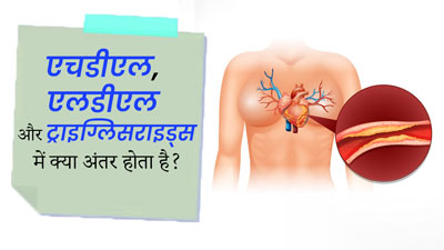 ट्राइग्लिसराइड्स, एचडीएल और एलडीएल कोलेस्ट्रॉल में क्या अंतर होता है? जानें डॉक्टर से