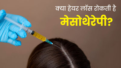 क्या वाकई 'मेसोथेरेपी' झड़ते बालों की समस्या को रोकती है? जानें हेयर फॉल रोकने में कैसे मददगार है यह ट्रीटमें