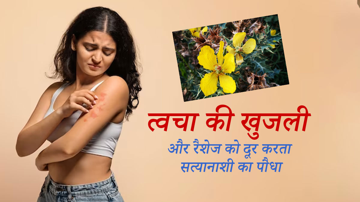 त्वचा की खुजली और रैशेज को दूर करता सत्यानाशी का पौधा, जानें इसके अन्य फायदे 