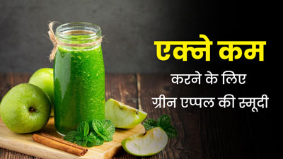 एक्ने या मुंहासों से परेशान हैं, पिएं ग्रीन एप्पल से बनी स्मूदी, मिलेगा फायदा