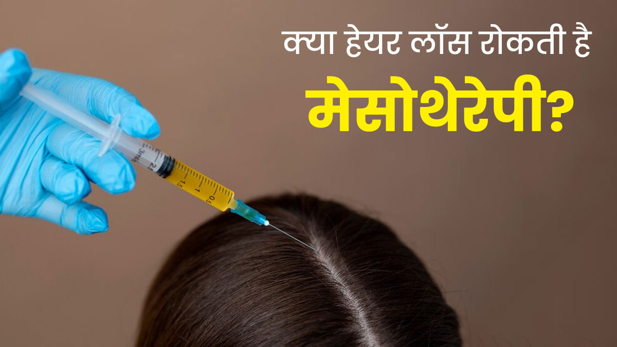 क्या वाकई 'मेसोथेरेपी' झड़ते बालों की समस्या को रोकती है? जानें हेयर फॉल रोकने में कैसे मददगार है यह ट्रीटमें
