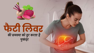 फैटी लिवर की समस्या होने पर करें चुकंदर का सेवन, मिलेंगे कई फायदे 