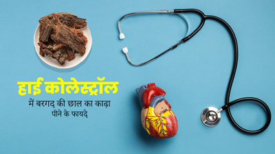 हाई कोलेस्ट्रॉल कम करने के लिए करें बरगद की छाल का काढ़ा, जानें सही तरीका