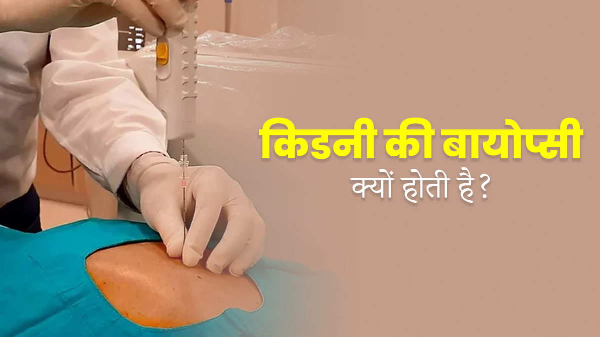 किडनी की बायोप्सी क्यों की जाती है? डॉक्‍टर से जानें 