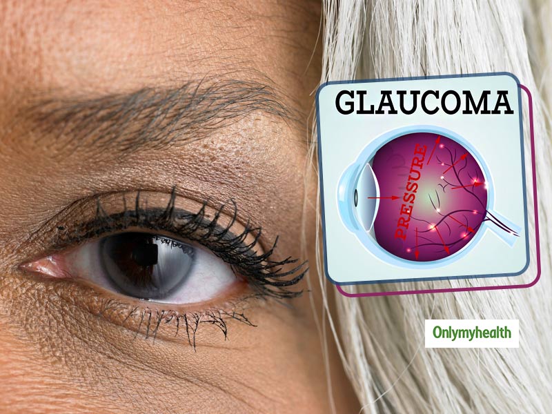 Vision at Risk: Expert Shares Silent Threat of Glaucoma and Vital Do's and Don'ts to Safeguard Your Eyesight