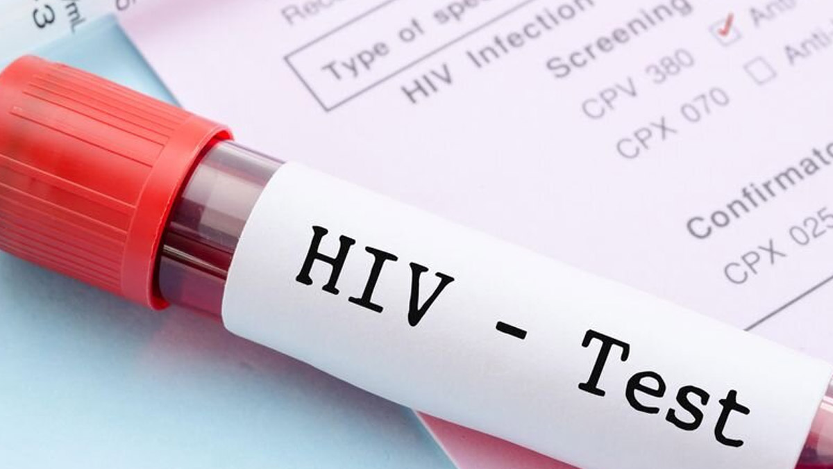 असम में बढ़ रहे HIV के मामले, स्वास्थ्य मंत्री ने नशीली दवाओं को बताई वजह