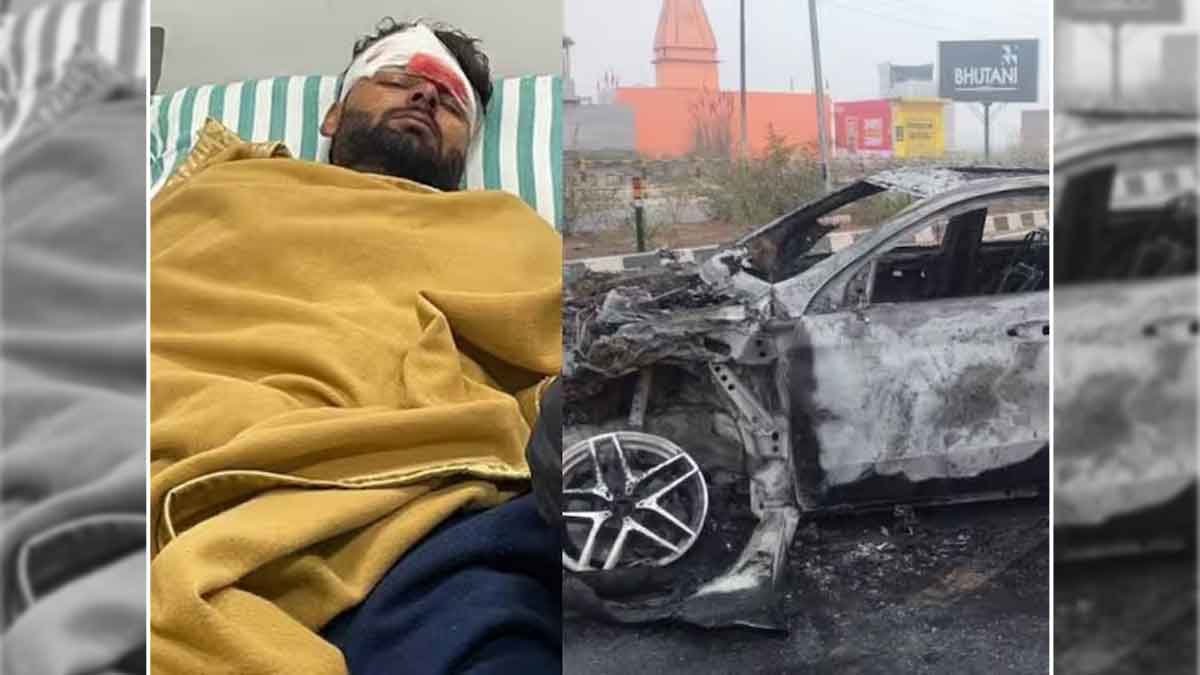 Rishabh Pant Shares His Restoration From Nearly Deadly Automotive Crash, Professional Lists Suggestions For Bone Well being Put up Fracture