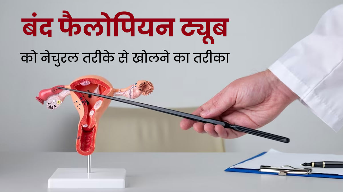 बिना सर्जरी के भी खोली जा सकती है ब्लॉक फैलोपियन ट्यूब, एक्सपर्ट से जानें खास टिप्स