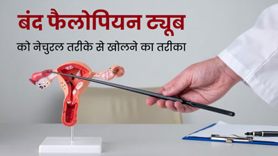 बिना सर्जरी के भी खोली जा सकती है ब्लॉक फैलोपियन ट्यूब, एक्सपर्ट से जानें खास टिप्स