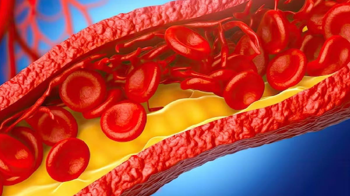 Amla Churna And Honey Benefits in High Cholesterol