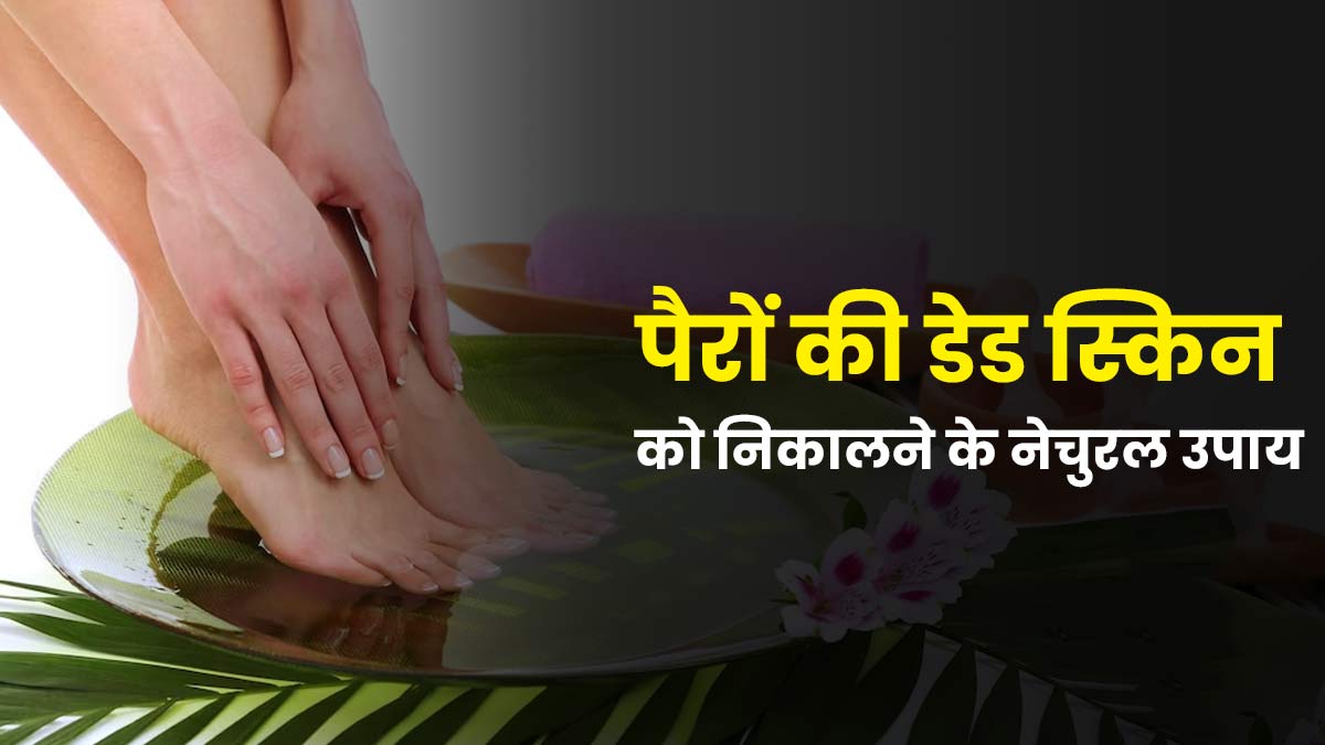 पैरों की डेड स्किन को निकालने के लिए अपनाएं ये 5 नेचुरल उपाय, खूबसूरत बनेंगे पैर