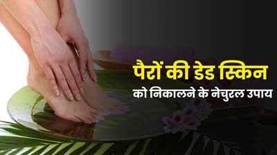 पैरों की डेड स्किन को निकालने के लिए अपनाएं ये 5 नेचुरल उपाय, खूबसूरत बनेंगे पैर