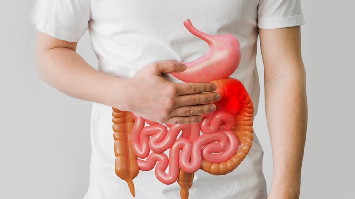 Life Expectancy With Stomach Cancer