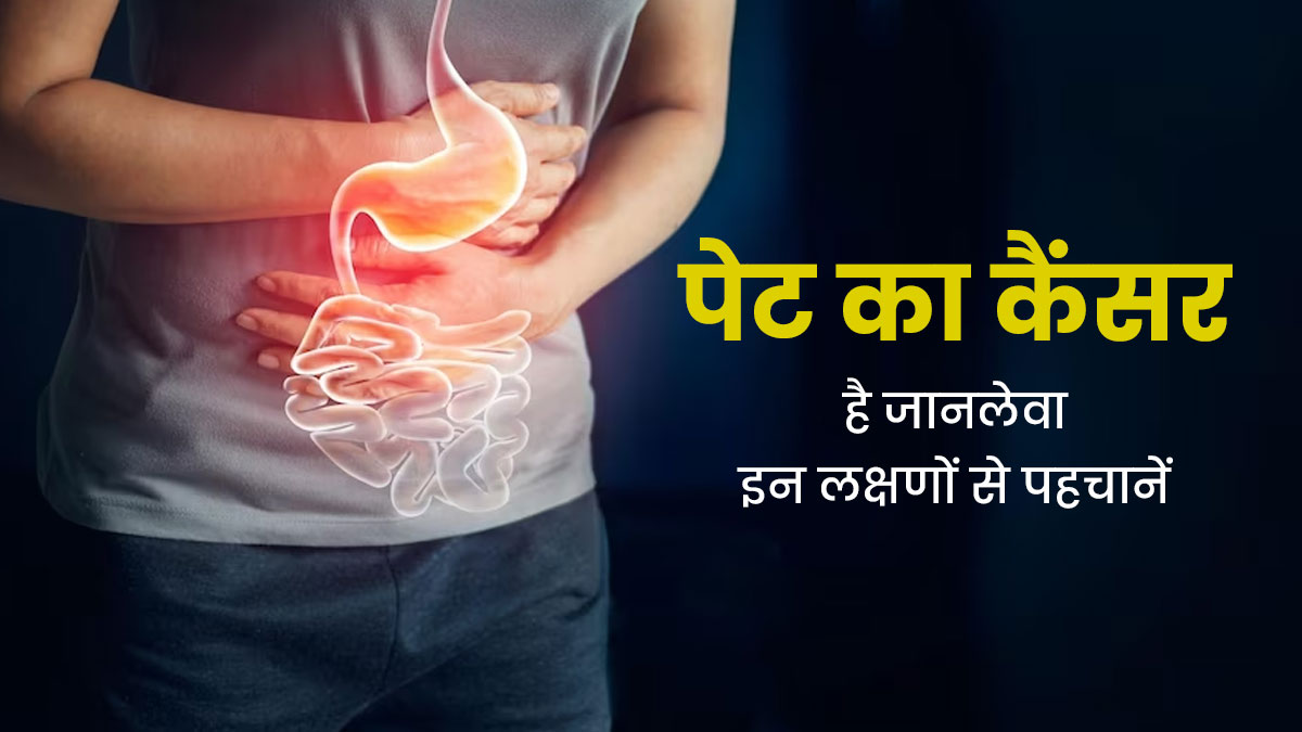 पेट का कैंसर होता है जानलेवा, महिलाएं इन लक्षणों को भूलकर भी न करें नजरअंदाज