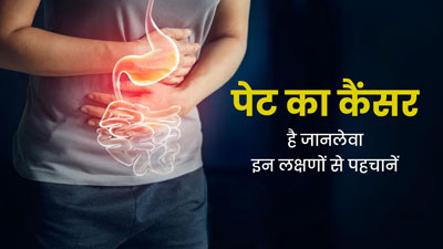 पेट का कैंसर होता है जानलेवा, महिलाएं इन लक्षणों को भूलकर भी न करें नजरअंदाज