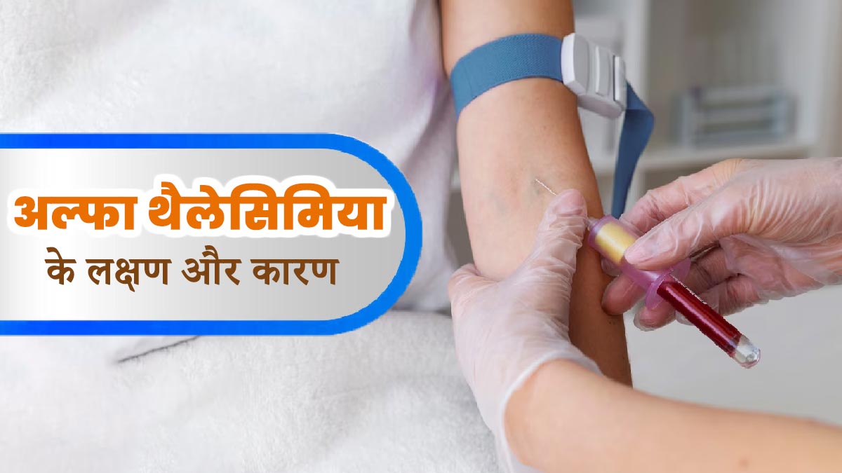 अल्फा थैलेसीमिया होने पर नजर आते हैं ये लक्षण, जानें इसके कारण भी