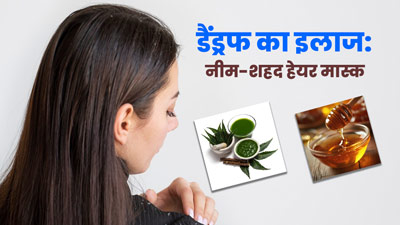 डैंड्रफ के लिए आजमाएं नीम और शहद से बना यह हेयर मास्क, जानें बनाने और लगाने का तरीका