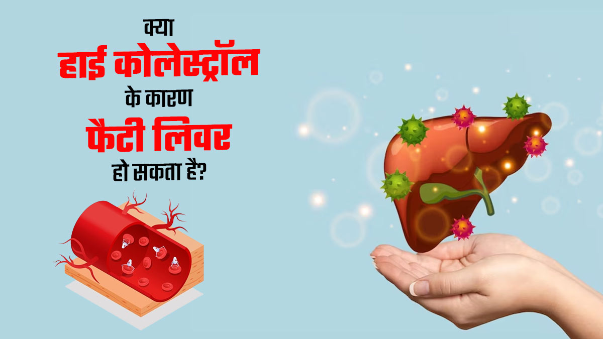 क्या हाई कोलेस्ट्रॉल की वजह से फैटी लिवर की समस्या हो सकती है? जानें बचाव
