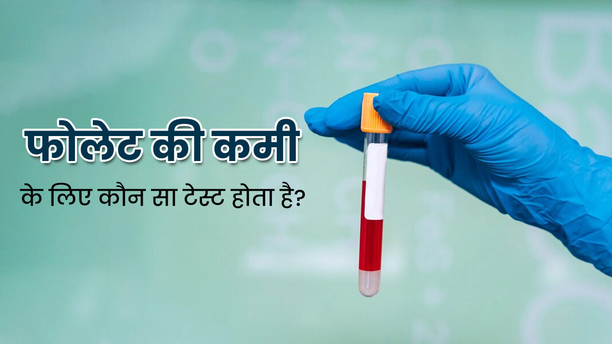 शरीर में फोलेट की कमी पता करने के लिए कौन सा टेस्ट होता है? जानें डॉक्टर से