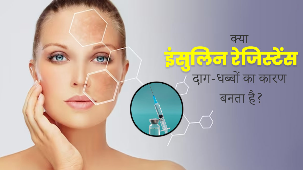क्या इंसुलिन रेजिस्टेंस की वजह से त्वचा पर दाग-धब्बे हो जाते हैं? एक्सपर्ट से जानें दोनों में संबंध