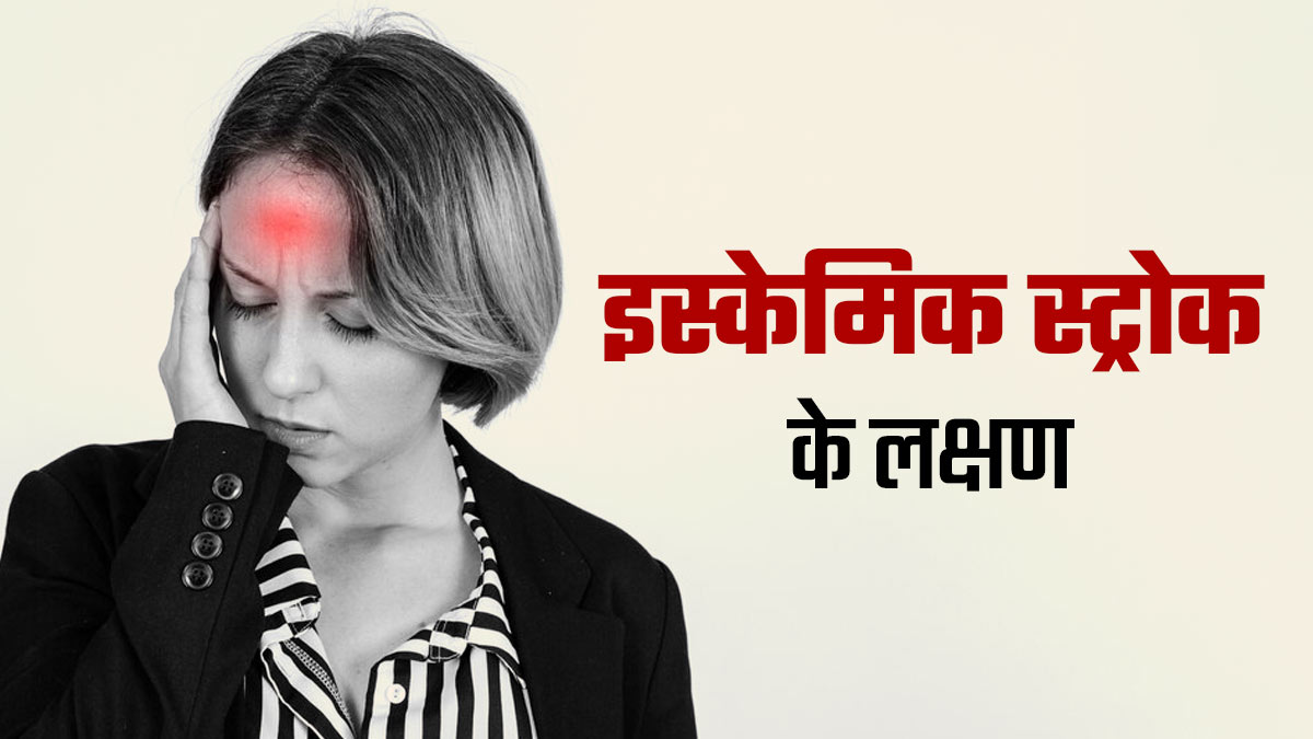 इस्केमिक स्ट्रोक आने पर शरीर में दिखते हैं ये लक्षण, डॉक्टर से जानें बचाव