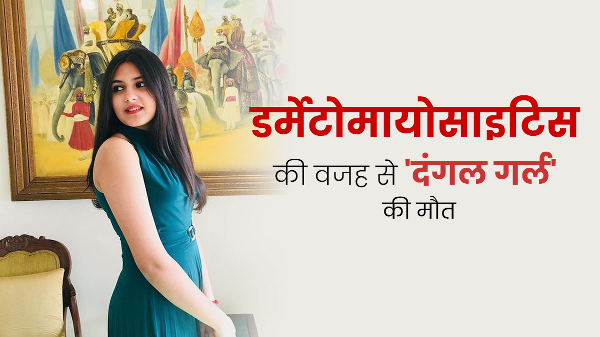 डर्मेटोमायोसाइटिस की वजह से 'दंगल गर्ल' सुहानी भटनागर  की मौत, जानें इस बीमारी के लक्षण