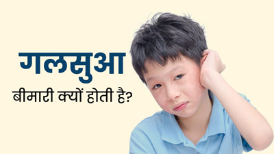 Mumps Causes: गलसुआ (मम्प्स) की समस्या क्यों होती है? जानें इसका कारण
