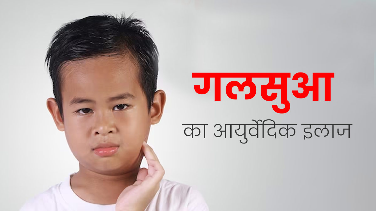 गलसुआ (मम्प्स) से छुटकारा पाने के लिए आयुर्वेद में इलाज कैसे किया जाता है? डॉक्टर से जानें