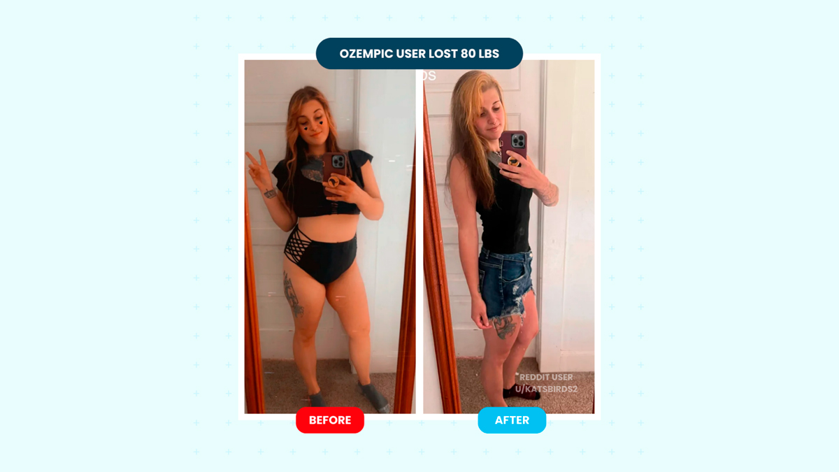 Ozempic Weight Loss Reviews — Before and After Photos OnlyMyHealth