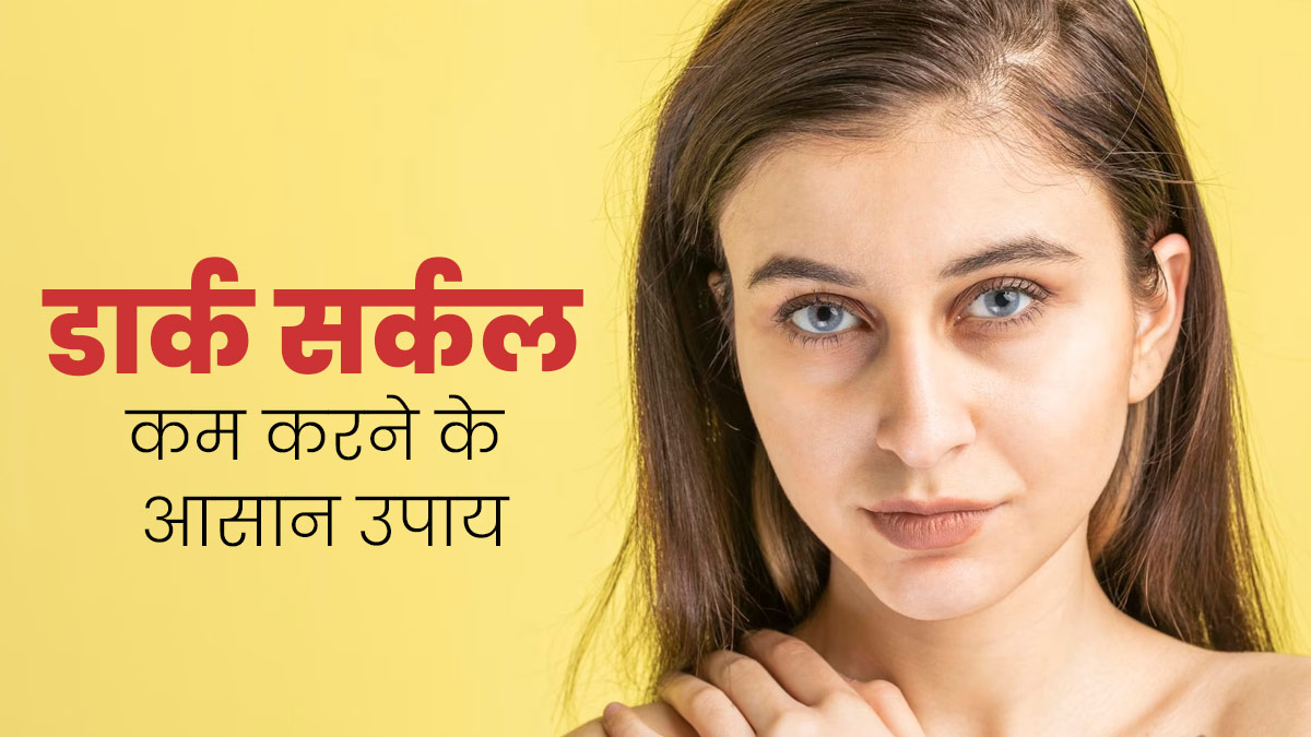 आंखों के नीचे हो गए हैं काले घेरे, तो हटाने के लिए आजमाएं ये घरेलू उपाय