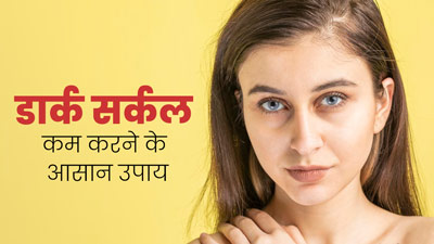 आंखों के नीचे हो गए हैं काले घेरे, तो हटाने के लिए आजमाएं ये घरेलू उपाय