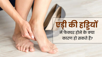 एड़ी की हड्डियों में फैक्चर क्यों हो जाता है? जानें इसके कारण और इलाज
