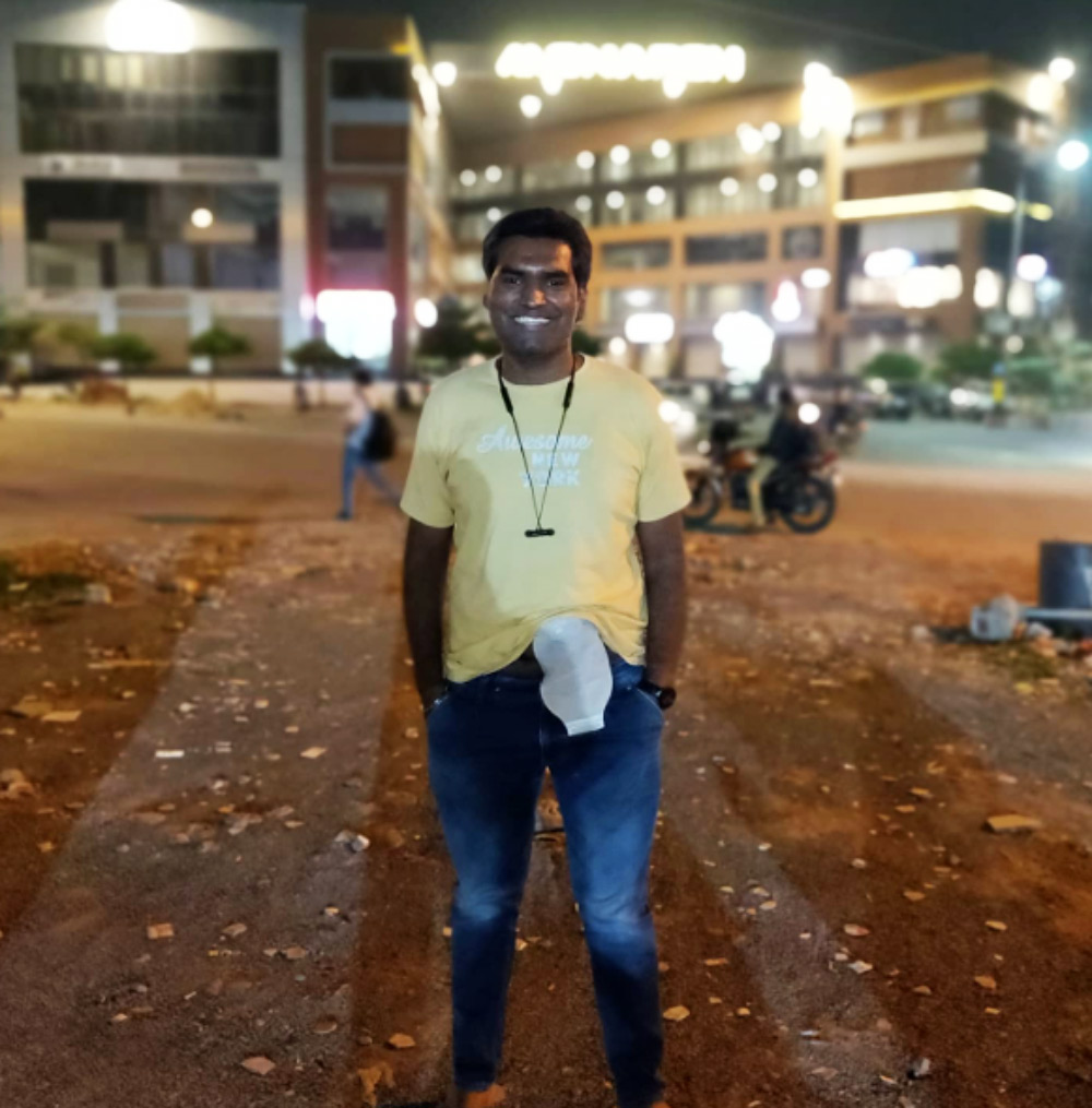 Symptoms of Colorectal Cancer 