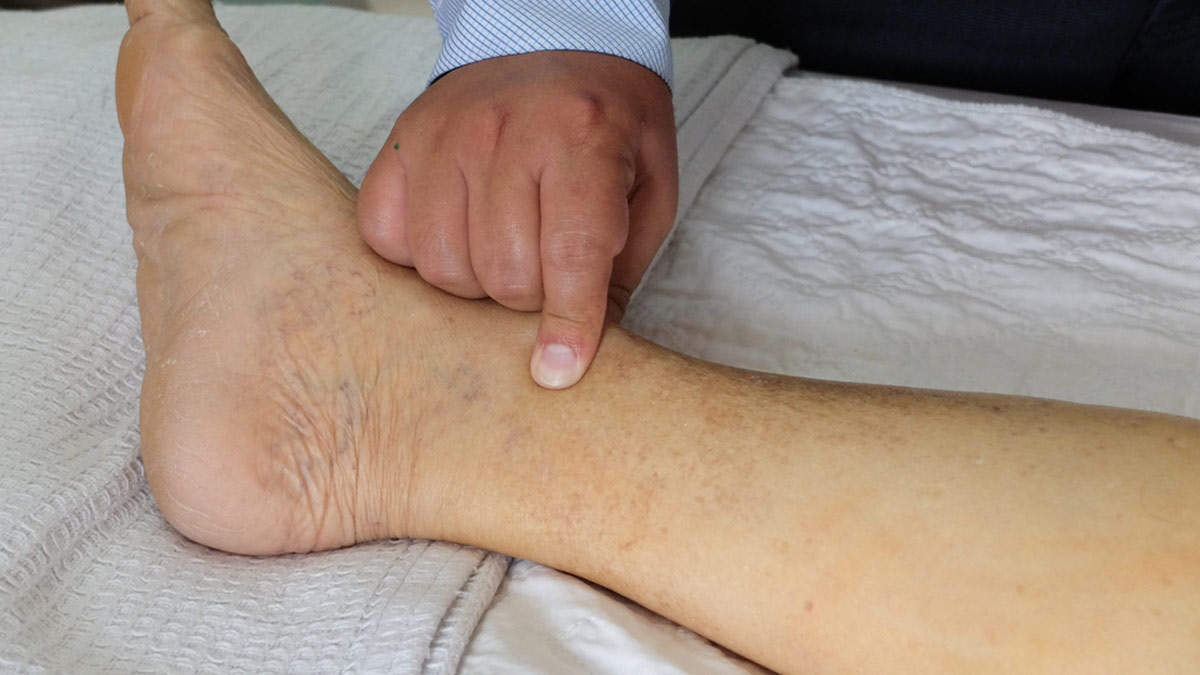 How fluid retention affects different parts of the body onlymyhealth