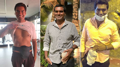 Conquering Cancer: How Dinesh Kundnani Navigated Life After Colorectal Cancer With A Stoma Bag