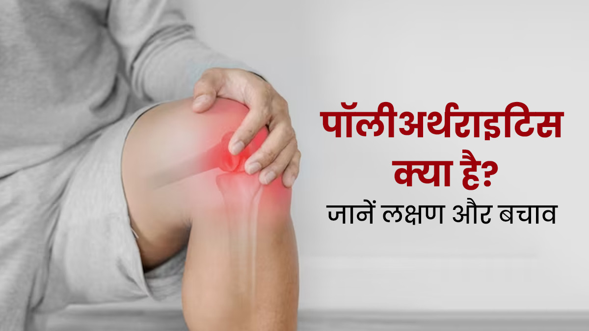 पॉलीअर्थराइटिस क्या है? डॉक्टर से जानें लक्षण और इलाज
