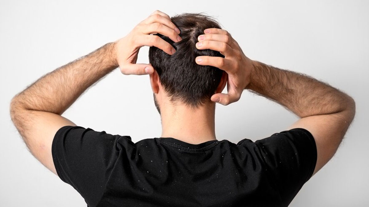 Does Your Scalp Hurt? Know About The 7 Possible Reasons Behind It