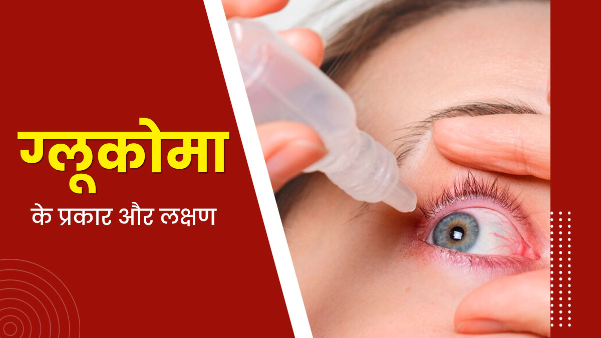 5 तरह का होता है ग्लूकोमा (काला  मोतियाबिंद), जानें इसके लक्षण और इलाज