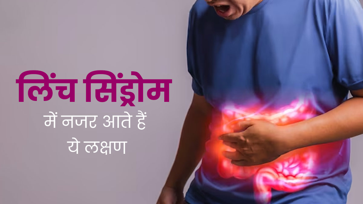जेनेटिक डिसऑर्डर 'लिंच सिंड्रोम' होने पर नजर आते हैं ये 5 लक्षण, न करें नजरअंदाज