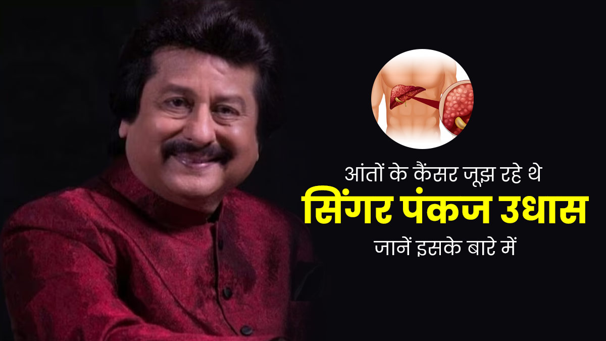 लंबे समय से आंतों के कैंसर जूझ रहे थे पंकज उधास, जानें इस बीमारी के कारण