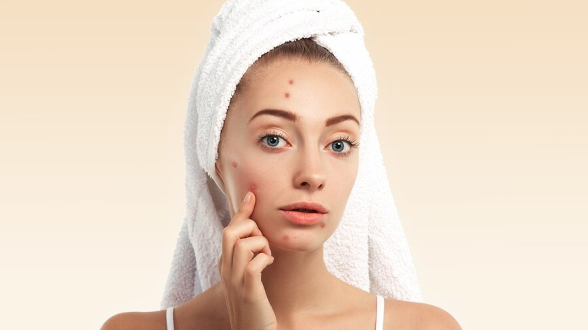 pimple