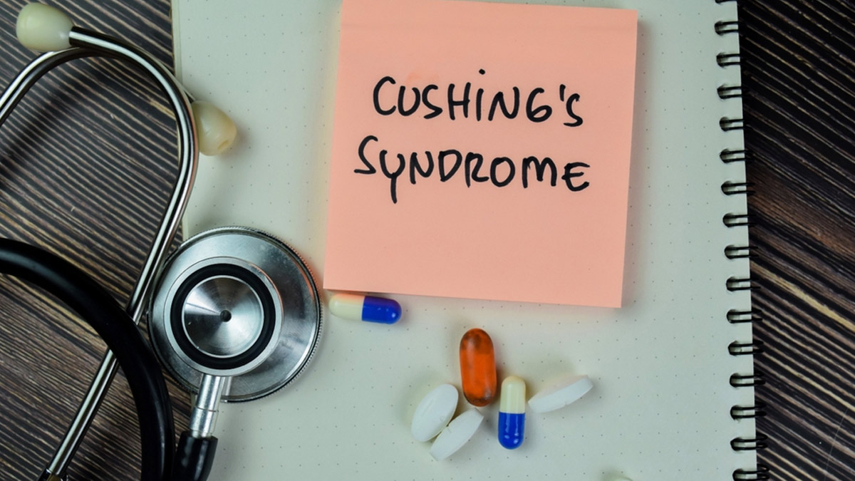 cushing syndrome
