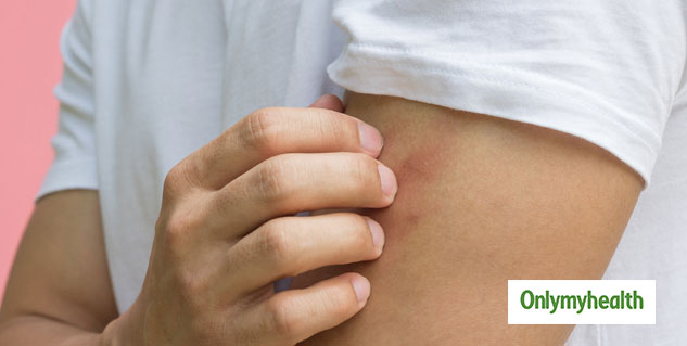 common symptoms of malaria and how to avoid it