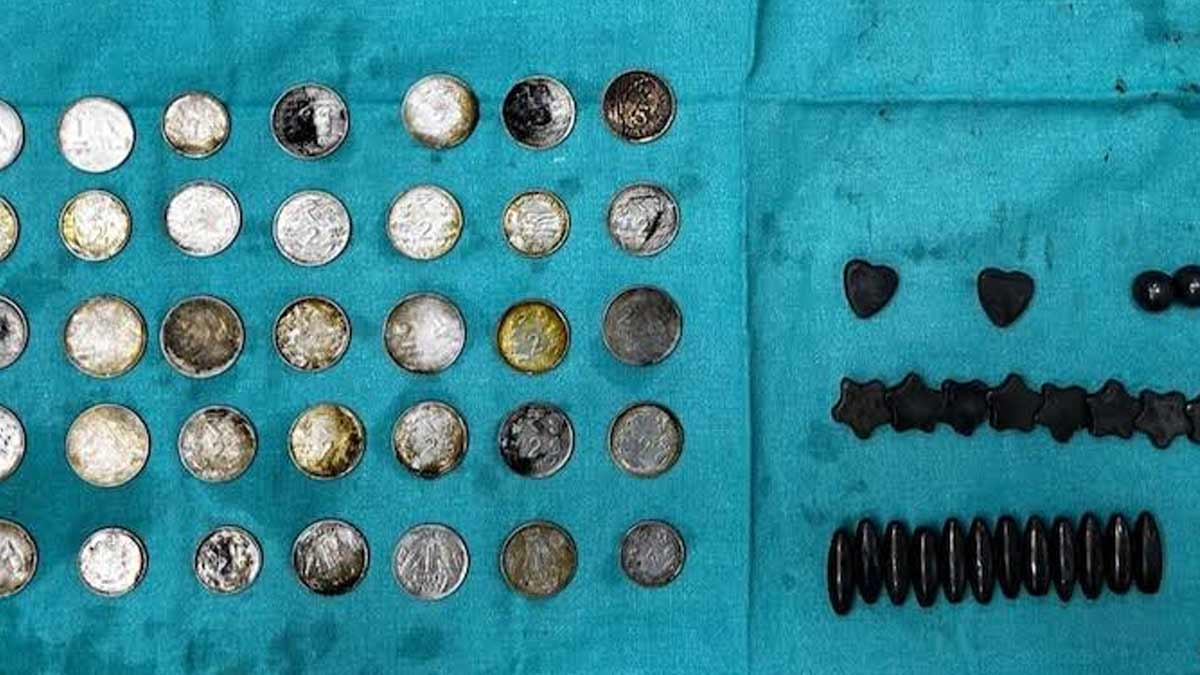 Man Swallows 39 Coins, 37 Magnets For A Zinc Rich Diet, Gets Hospitalised: Here Are Better Alternatives
