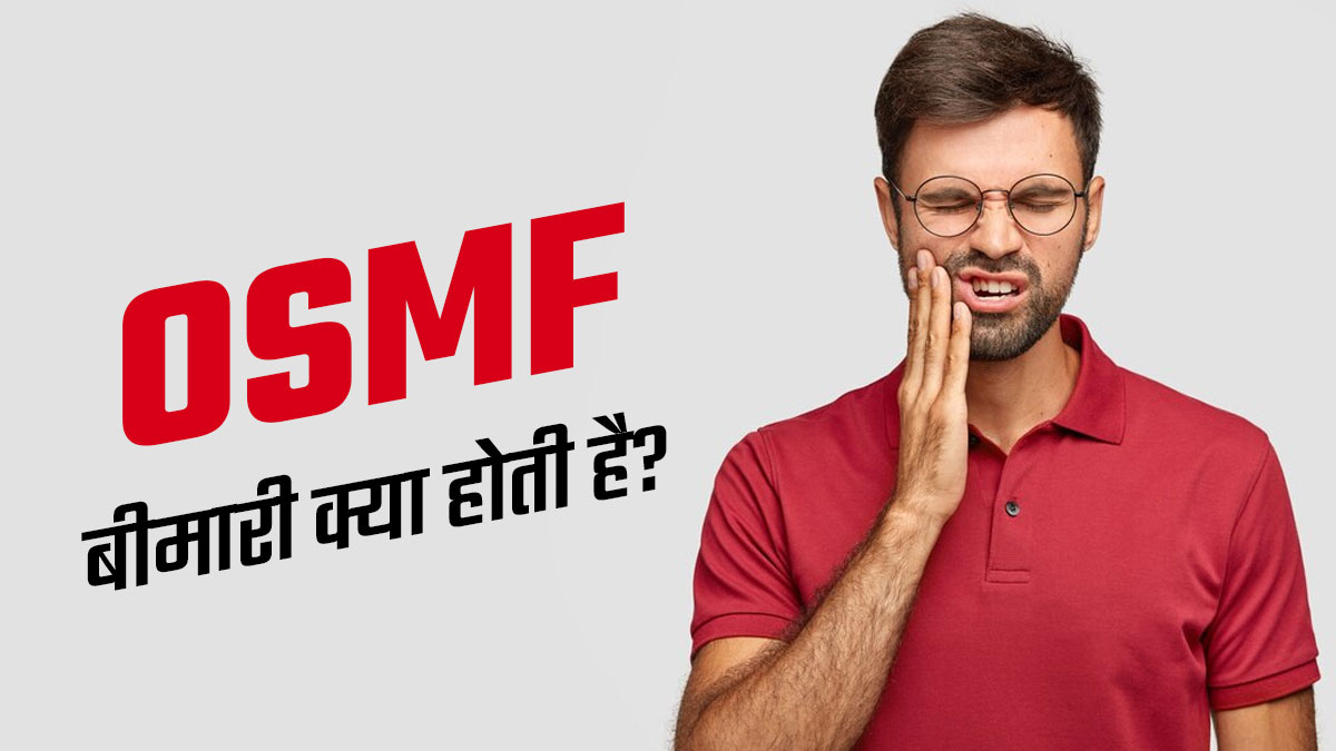 पान मसाला और तंबाकू खाने वाले लोगों को होता है OSMF बीमारी का खतरा, जानें इसके लक्षण