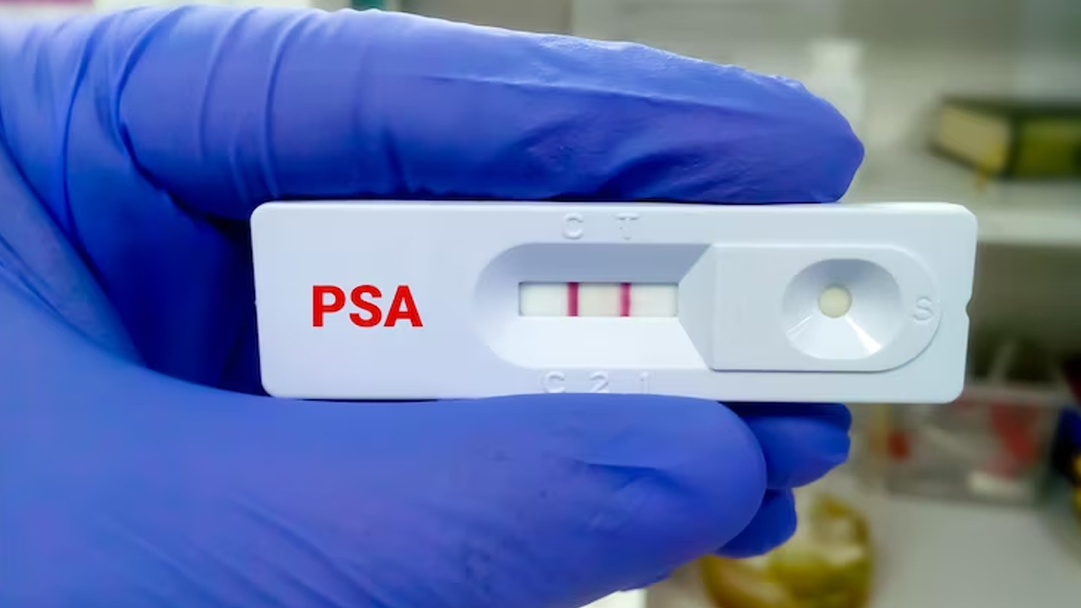 low psa levels with enlarged prostate        
        <figure class=