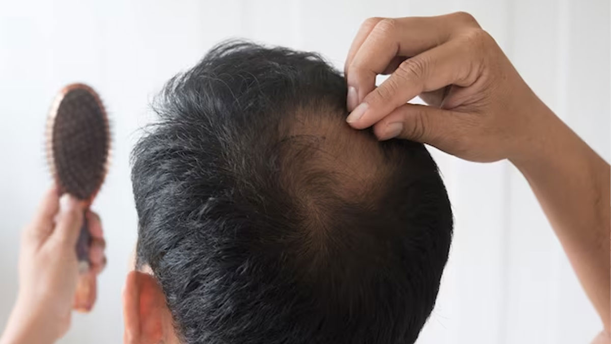 balchad and mustard oil for hair fall 