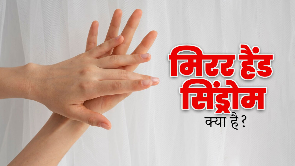 मिरर हैंड सिंड्रोम क्या है? जानें इसके कारण, लक्षण और इलाज