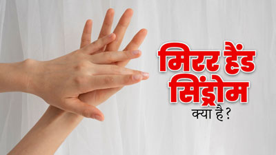 मिरर हैंड सिंड्रोम क्या है? जानें इसके कारण, लक्षण और इलाज